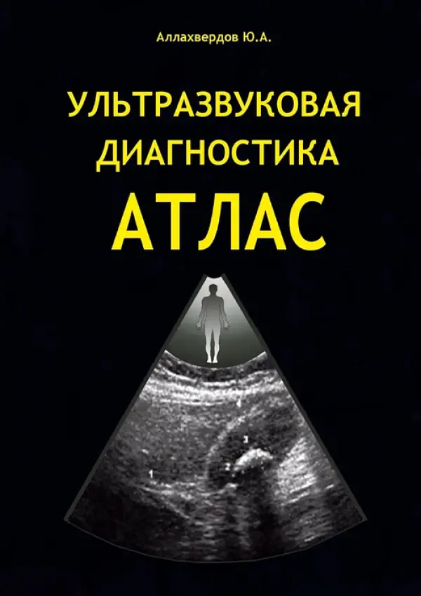 Ультразвуковая діагностика АТЛАС (Аллахвердов Ю.А.)